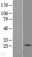 C1orf105 Human Over-expression Lysates NM_139240