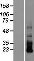 CRB3 Human Over-expression Lysates NM_174881