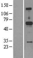 ACPL2 (PXYLP1) Human Over-expression Lysates NM_152282
