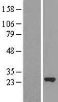 MRRF Human Over-expression Lysates NM_138777