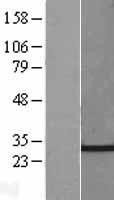 CHMP4C Human Over-expression Lysates NM_152284