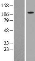 SPECC1 Human Over-expression Lysates NM_001033555