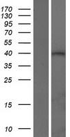 ls092552 atxn3l human over expression lysates nm 001135995 wb testing 1