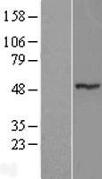 ZNF764 Human Over-expression Lysates NM_033410