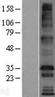 ls092691 tmem169 human over expression lysates nm 138390 wb testing 1