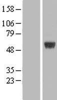 ARRDC1 Human Over-expression Lysates NM_152285