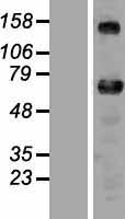 ls092822 znf276 human over expression lysates nm 152287 wb testing 1
