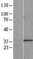 IMP4 Human Over-expression Lysates NM_033416