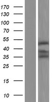 UBE2Q2 Human Over-expression Lysates NM_001145335