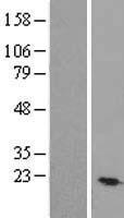 TEX30 Human Over-expression Lysates NM_138779