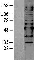 ls093100 naprt1 naprt human over expression lysates nm 145201 wb testing 1