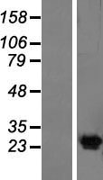 KCNG4 Human Over-expression Lysates NM_133490
