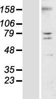 TMEM44 Human Over-expression Lysates NM_001011655
