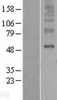 ORAI3 Human Over-expression Lysates NM_152288