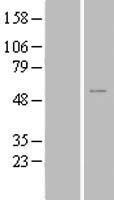 ls093134 znf561 human over expression lysates nm 152289 wb testing 1