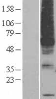 PIGM Human Over-expression Lysates NM_145167