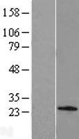 C1orf158 Human Over-expression Lysates NM_152290