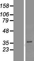 PGAP3 Human Over-expression Lysates NM_033419