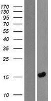LEMD1 Human Over-expression Lysates NM_001001552