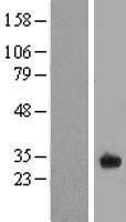 FAM125A (MVB12A) Human Over-expression Lysates NM_138401