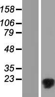 MMGT1 Human Over-expression Lysates NM_173470