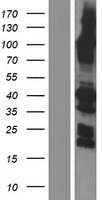 SYCE1 Human Over-expression Lysates NM_001143764
