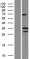 SYCE1 Human Over-expression Lysates NM_130784