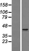 ls093474 znf670 human over expression lysates nm 033213 wb testing 1