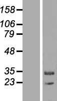 ls093487 mapk1ip1l human over expression lysates nm 144578 wb testing 1