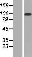 ls093594 wdr67 tbc1d31 human over expression lysates nm 145647 wb testing 1