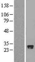 FBXO44 Human Over-expression Lysates NM_033182