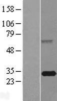FBXO44 Human Over-expression Lysates NM_183412