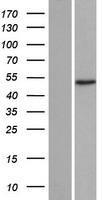 ls093624 ada2 beta tada2b human over expression lysates nm 152293 wb testing 1