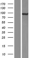 HSPC302 (TBCK) Human Over-expression Lysates NM_033115