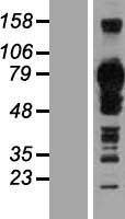 TJAP1 Human Over-expression Lysates NM_080604