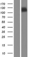 Myocardin (MYOCD) Human Over-expression Lysates NM_001146312