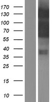 Myocardin (MYOCD) Human Over-expression Lysates NM_001146313
