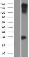 Myocardin (MYOCD) Human Over-expression Lysates NM_153604