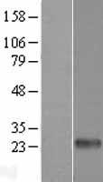 DECTIN 2 (CLEC6A) Human Over-expression Lysates NM_001007033