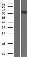 FOXP2 Human Over-expression Lysates NM_014491