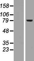 FOXP2 Human Over-expression Lysates NM_148899