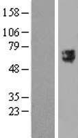 TTYH2 Human Over-expression Lysates NM_032646