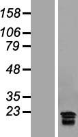 hCG beta (CGB7) Human Over-expression Lysates NM_033142