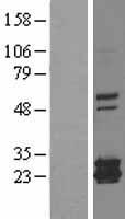 Mitochondrial Ferritin (FTMT) Human Over-expression Lysates NM_177478