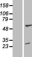 ls094039 znf101 human over expression lysates nm 033204 wb testing 1