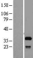 SFXN1 Human Over-expression Lysates NM_022754
