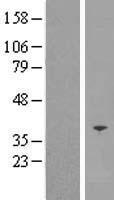 SFXN5 Human Over-expression Lysates NM_144579