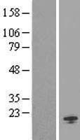 ORMDL1 Human Over-expression Lysates NM_016467