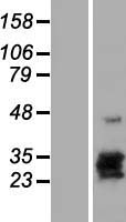 ls094115 hcg beta cgb8 human over expression lysates nm 033183 wb testing 1
