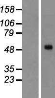 Melanopsin (OPN4) Human Over-expression Lysates NM_033282
